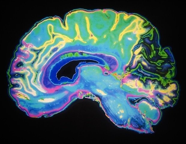 New discovery overturns a prevailing model of brain development