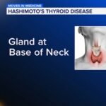 Tired, gaining weight, always cold? It could be the thyroid | Moves in Medicine