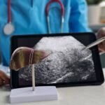 AI Predicts Diabetes Risk in Patients with Liver Disease