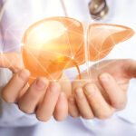 Immunotherapy-Based Downstaging Linked to Improved Outcomes After Liver Transplantation in Hepatocellular Carcinoma